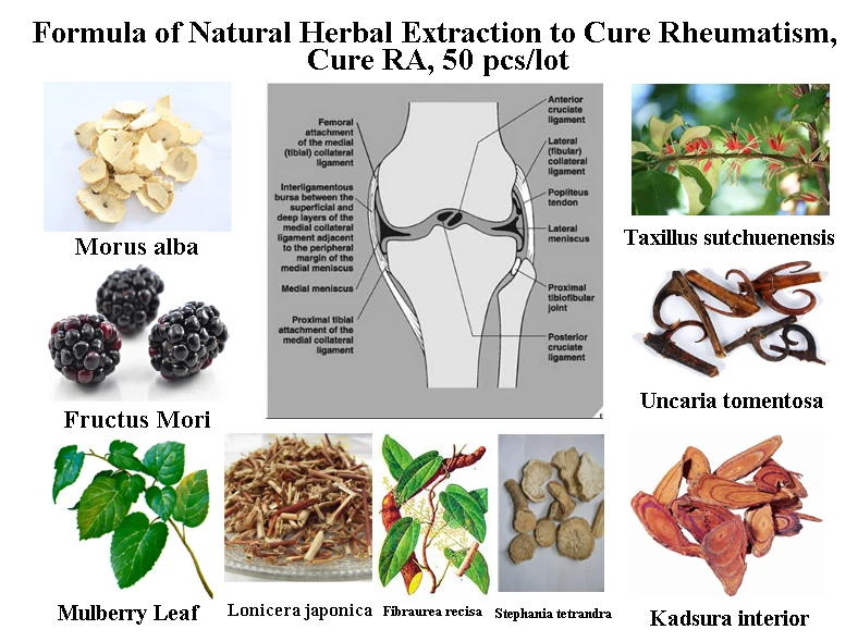 Formula of Natural Herbal Extraction to Cure Rheumatism, Cure RA, 50 pcs/lot