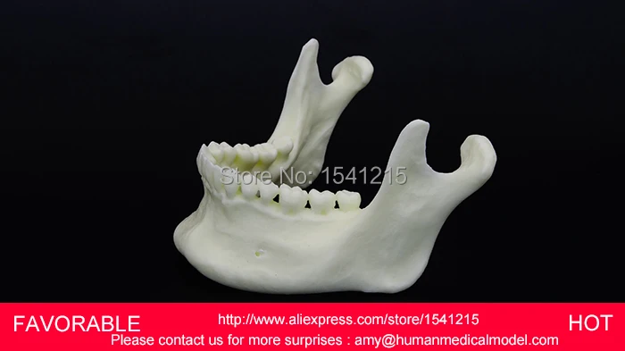 DENTAL MATERIALS TOOTH PATHOLOGY DISSECTION MODEL DECAYED TOOTH GINGIVAL SIMULATION MODEL OF MANDIBULAR TEETH-GASEN-DEN030
DENTAL MATERIALS TOOTH PATHOLOGY DISSECTION MODEL DECAYED TOOTH GINGIVAL SIMULATION MODEL OF MANDIBULAR TEETH-GASEN-DEN030