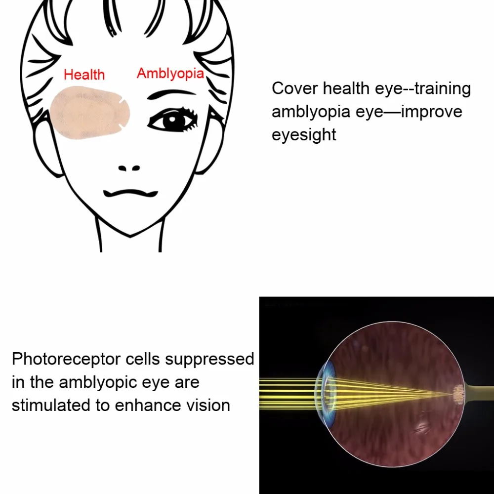Orthoptic Eye Patches For Children With Amblyopia Posted Monocular Full Cover Training Amblyopia Correction Beige 20Pcspack (6)