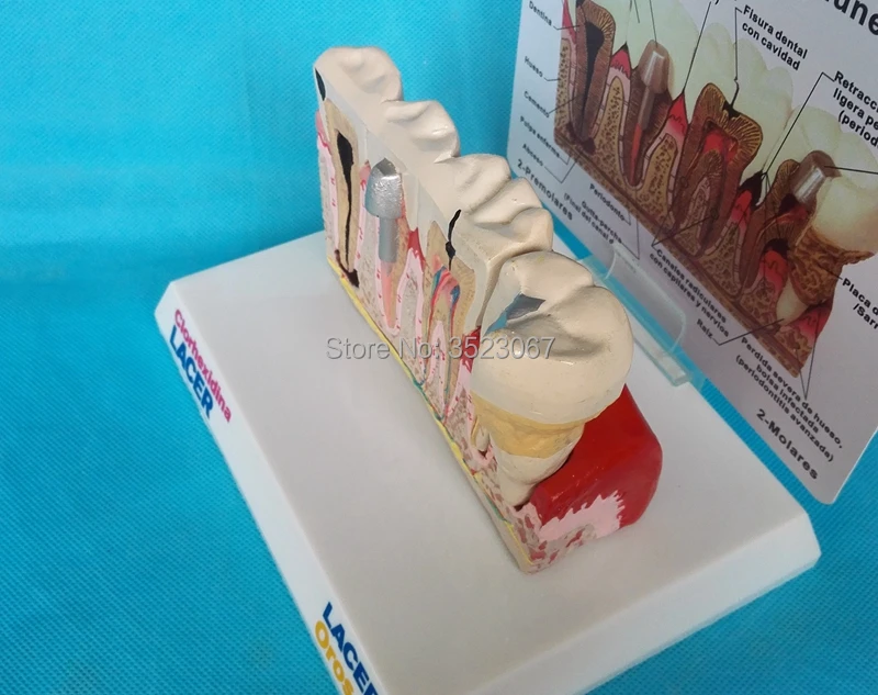 Human anatomy skeleton Human Hand Skeleton Medical Anatomical Model on Base brain skull model in trauma medical instruments
Human anatomy skeleton Human Hand Skeleton Medical Anatomical Model on Base brain skull model in trauma medical instruments