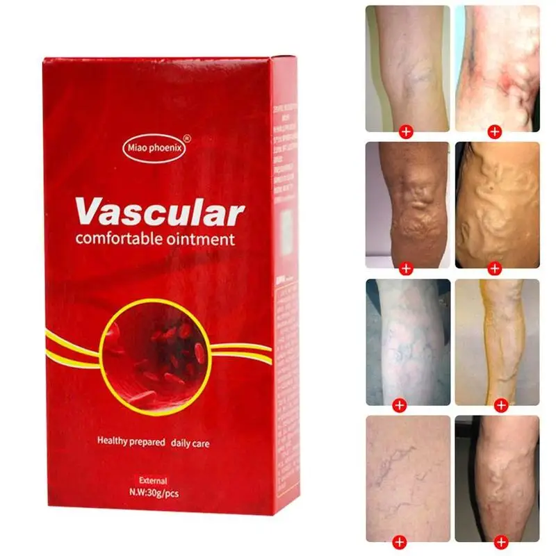 Varicose Veins Treatment Cream Ointment Vasculitis Phlebitis Spider Veins Pain Varicosity Angiitis Remedy Removal Herbal Cream
Varicose Veins Treatment Cream Ointment Vasculitis Phlebitis Spider Veins Pain Varicosity Angiitis Remedy Removal Herbal Cream