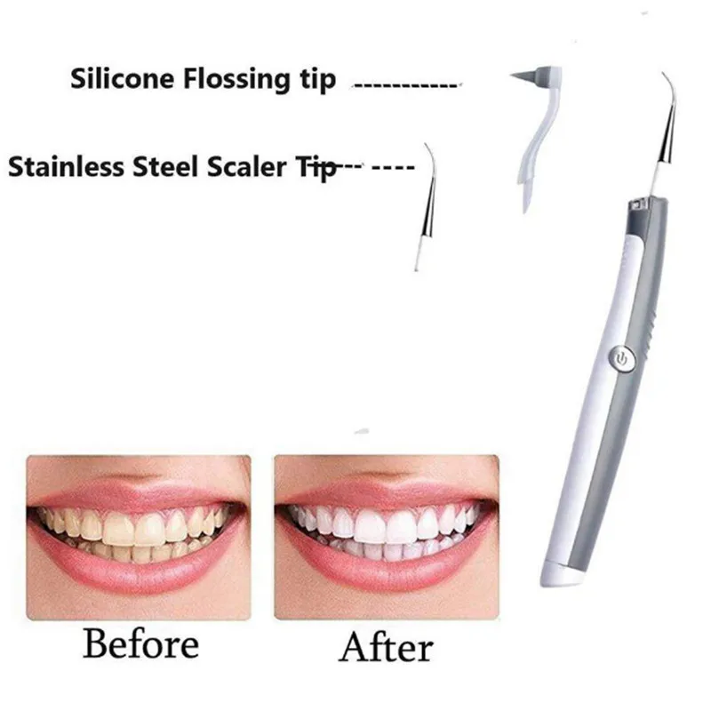 Teeth Whitening (5).jpg