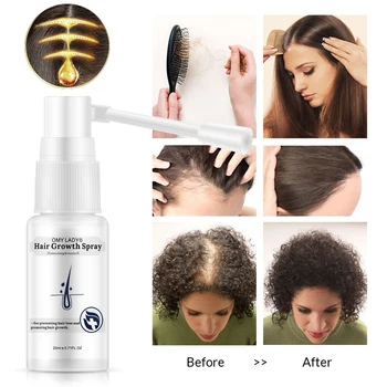 Hair Growth Spray Essential Oil Liquid Scalp Treatments Anti Hair Loss Dry Regeneration Repair Hair Loss Products For Women Men
Hair Growth Spray Essential Oil Liquid Scalp Treatments Anti Hair Loss Dry Regeneration Repair Hair Loss Products For Women Men