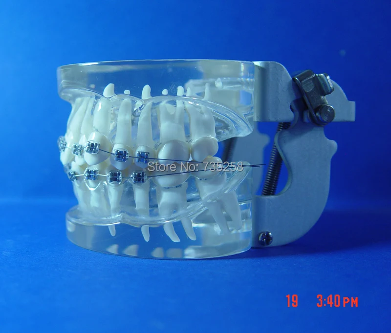 Teeth Orthodontic Model,Metal Braces Teeth Wrong Jaws Model Demonstration,Tooth Orthodontic Training Model
Teeth Orthodontic Model,Metal Braces Teeth Wrong Jaws Model Demonstration,Tooth Orthodontic Training Model