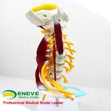 Medical human cervical model brachial plexus neuromuscular model human skeletal specimen model
Medical human cervical model brachial plexus neuromuscular model human skeletal specimen model