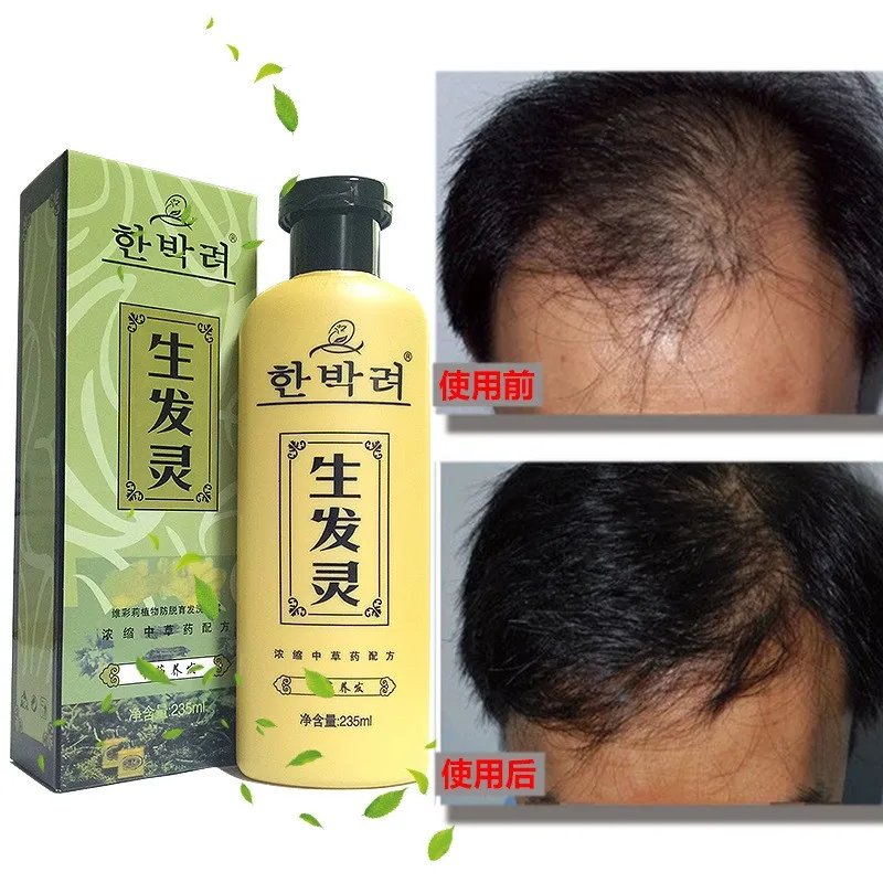 Manting Chinese Herbal Medicine Anti Dandruff Itching Shampoo Balancing Oil Control Nourishing Shampoo Professional Hair Care
Manting Chinese Herbal Medicine Anti Dandruff Itching Shampoo Balancing Oil Control Nourishing Shampoo Professional Hair Care