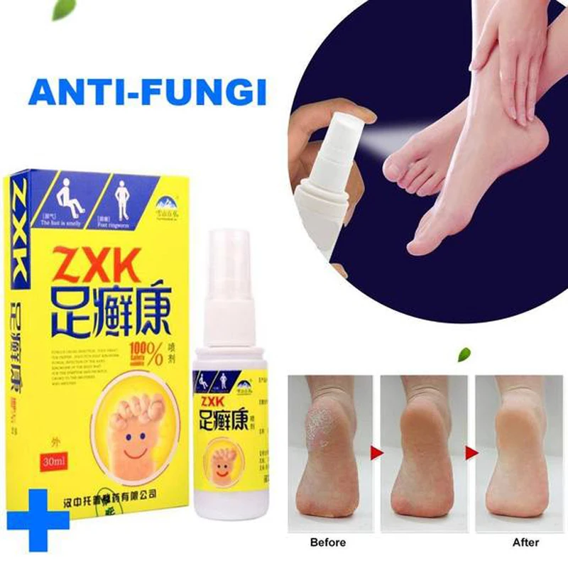Herbal Anti-fungi Athlete Foot Spray Foot Care Antibacterial Deodorant Powder Anti Itch Sweat Odor Feet Liquid Anti-fungi Spray
Herbal Anti-fungi Athlete Foot Spray Foot Care Antibacterial Deodorant Powder Anti Itch Sweat Odor Feet Liquid Anti-fungi Spray
