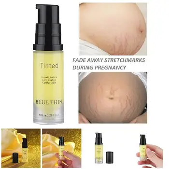 Stretch Marks Repair Cream Removal Scar Marks Cream Fat Scar Striae Treatment SDFA88
Stretch Marks Repair Cream Removal Scar Marks Cream Fat Scar Striae Treatment SDFA88