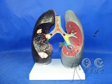 human model Smoking carcinogenic and Healthy lung model visceral resin free shipping
human model Smoking carcinogenic and Healthy lung model visceral resin free shipping