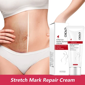 EFERO Stretch Marks Removal Cream Repair Pregnancy Scars Maternity Anti-Aging Winkles Firming Skin Smooth Body Skin Care Creams
EFERO Stretch Marks Removal Cream Repair Pregnancy Scars Maternity Anti-Aging Winkles Firming Skin Smooth Body Skin Care Creams