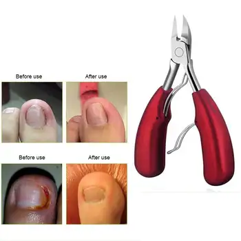 Stainless Steel Double Springs Fingernail Toenail Cuticle Nipper Trimming Cutter Scissor Plier Nail Clipper Kit MH88
Stainless Steel Double Springs Fingernail Toenail Cuticle Nipper Trimming Cutter Scissor Plier Nail Clipper Kit MH88