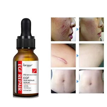 Facial Skin Care EGF freeze-dried powder oligopeptide solution repair scar acne printed red blood acne essence shrink pores
Facial Skin Care EGF freeze-dried powder oligopeptide solution repair scar acne printed red blood acne essence shrink pores