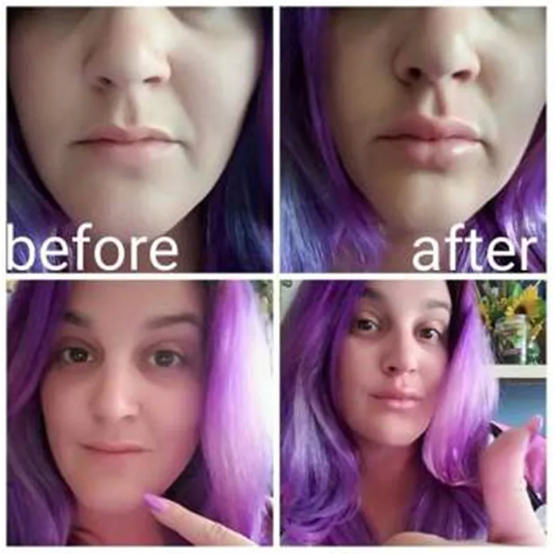 Women-Sexy-Full-Lip-Plumper-Enhancer-Lips-Silicone-Fish-Shape-Plump-Thicken-Labium-Tools-Natural-Pout