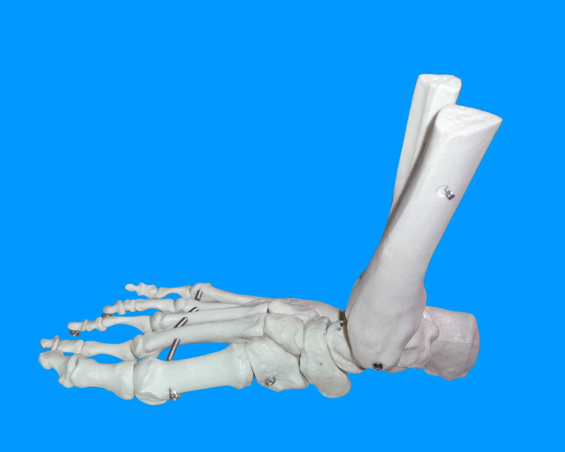 1:1 Human Foot Joint Ankle Joint Bone Model Medical Anatomy Skeleton Model Teaching Tool Supplier
1:1 Human Foot Joint Ankle Joint Bone Model Medical Anatomy Skeleton Model Teaching Tool Supplier