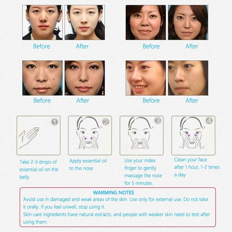 QX0223A (9)