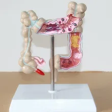 Human colon Disease model the large intestine Pathological model Gastroenterology Aids 25*15*14CM free shipping
Human colon Disease model the large intestine Pathological model Gastroenterology Aids 25*15*14CM free shipping