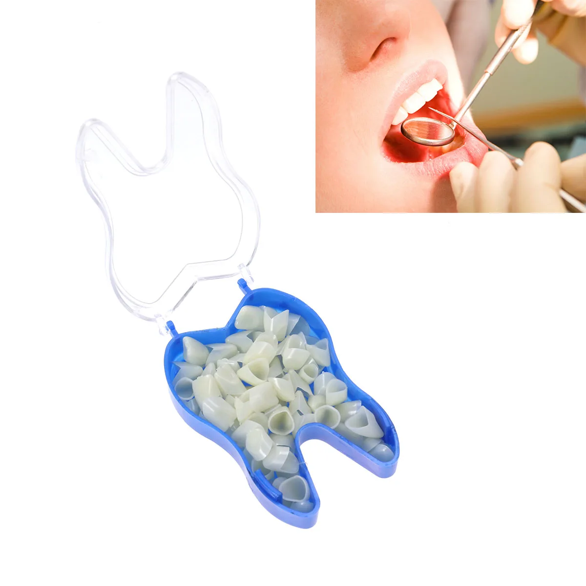 Front Molar Posterior Tooth False Teeth Teeth Whitening Denture Perfect Instant Smile Comfort Fit Crown Anteriors
Front Molar Posterior Tooth False Teeth Teeth Whitening Denture Perfect Instant Smile Comfort Fit Crown Anteriors
