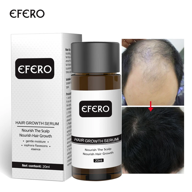 Hair Care Hair Growth Essential Oils Essence Anti Preventing Hair Loss Products Beauty Dense Fast Original Hair Growth Serum
Hair Care Hair Growth Essential Oils Essence Anti Preventing Hair Loss Products Beauty Dense Fast Original Hair Growth Serum