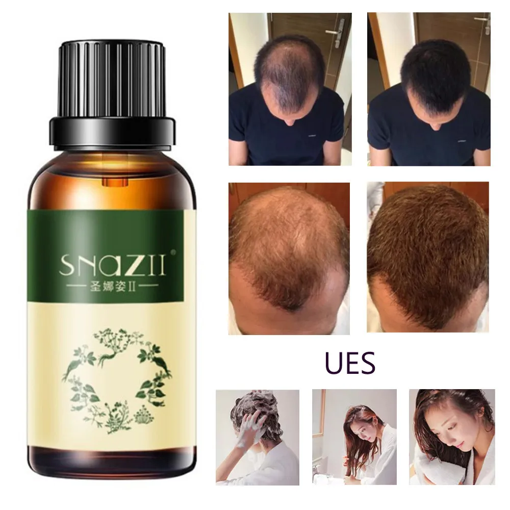 30ML Professional Hairs Growth Essence Advanced Thinning Hair & Hair Loss Supplement Hairs Care Products Long Lasting Drop
30ML Professional Hairs Growth Essence Advanced Thinning Hair & Hair Loss Supplement Hairs Care Products Long Lasting Drop
