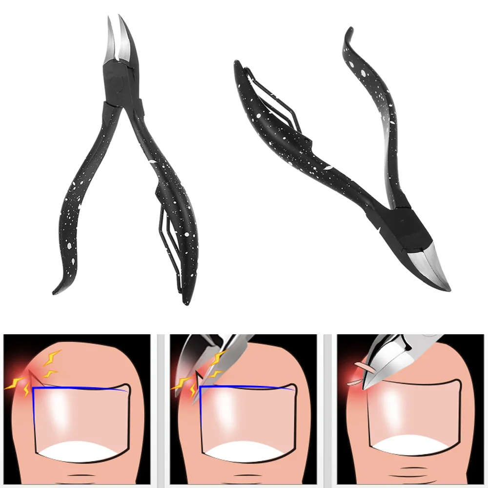 Professional Toenail Ingrown Cuticle Nipper Clipper Edge Cutter Manicure Scissor Plier Tool Pedicure Dead Skin Remover Tool
Professional Toenail Ingrown Cuticle Nipper Clipper Edge Cutter Manicure Scissor Plier Tool Pedicure Dead Skin Remover Tool