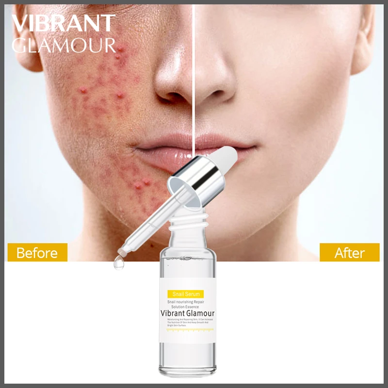 VIBRANT GLAMOUR Snail Acne Face Serum Hyaluronic Acid Anti Aging Wrinkles Facial Essence Liquid Brightening Moisturizing Repair
VIBRANT GLAMOUR Snail Acne Face Serum Hyaluronic Acid Anti Aging Wrinkles Facial Essence Liquid Brightening Moisturizing Repair