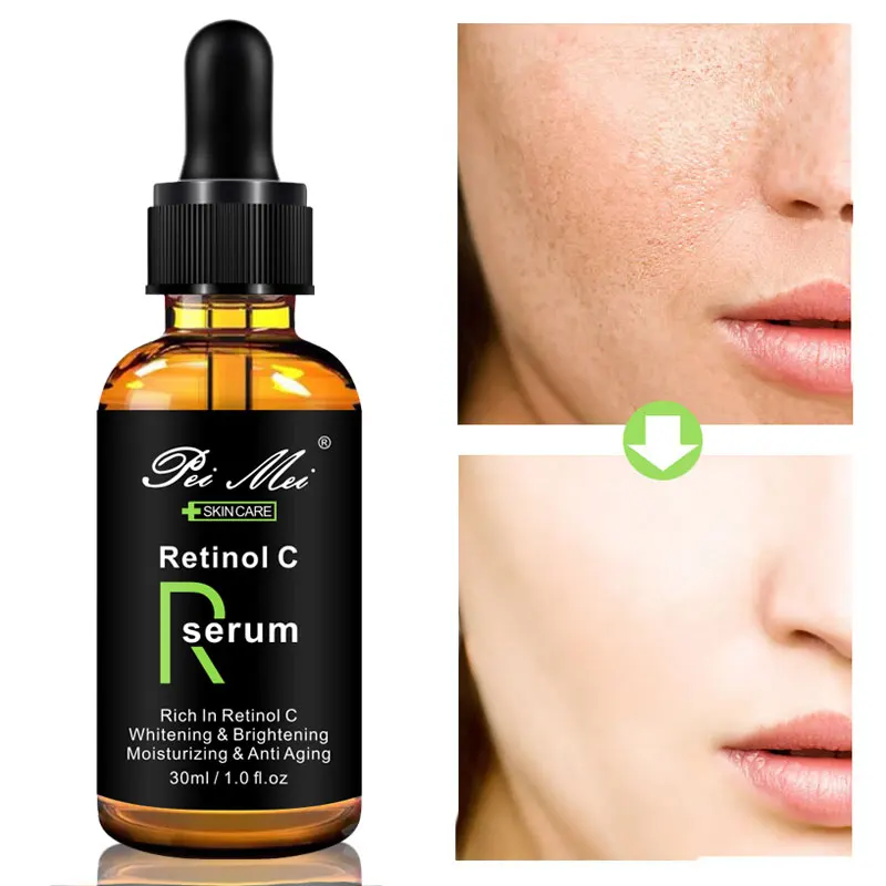 Pei Mei Retinol C Serum Face Whitening Reduces Age Spots anti Freckles Fade Dark Spot treatment freckles Facial Moisturizer
Pei Mei Retinol C Serum Face Whitening Reduces Age Spots anti Freckles Fade Dark Spot treatment freckles Facial Moisturizer