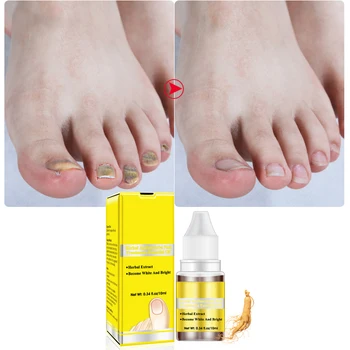OEDO Herbal Ginseng Antibacterial Repair Nail Essential O il for Becoming Whiter and Brighter Foot Massage Health Care
OEDO Herbal Ginseng Antibacterial Repair Nail Essential O il for Becoming Whiter and Brighter Foot Massage Health Care