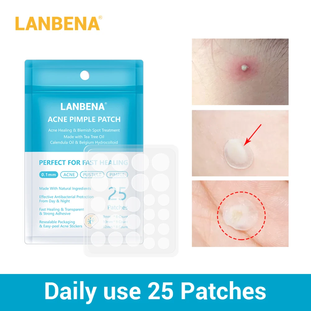LANBENA Daily Use Tea Tree Acne Patch Set 25 Stickers Pimple Treatment Acne Pimple Master Patch Pimple Treatment Acne Stickers
LANBENA Daily Use Tea Tree Acne Patch Set 25 Stickers Pimple Treatment Acne Pimple Master Patch Pimple Treatment Acne Stickers