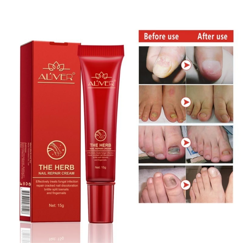 1pc Nail Repair Cream Nail Health Care Makeup Nail Treatment Maquiagem Nail Repair Hot Sale New Arrival Dropshipping
1pc Nail Repair Cream Nail Health Care Makeup Nail Treatment Maquiagem Nail Repair Hot Sale New Arrival Dropshipping