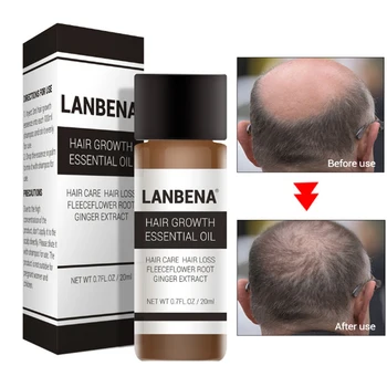 LANBENA Fast Powerful Hair Growth Essence Products Essential Oil Liquid Treatment Preventing Preventing Hair Loss Hair Care
LANBENA Fast Powerful Hair Growth Essence Products Essential Oil Liquid Treatment Preventing Preventing Hair Loss Hair Care