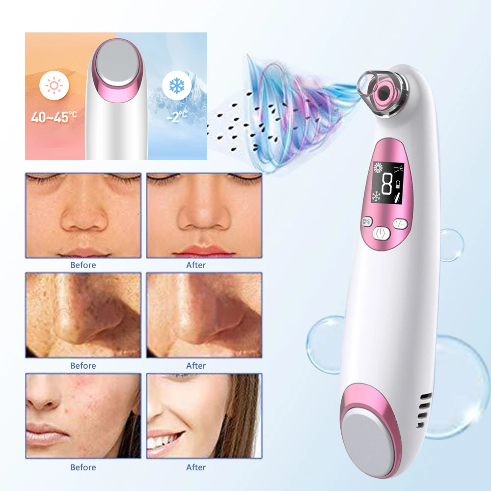 Blackhead Remover Device Vacuum Pore Cleaner Electric Cleansing Comedone Extraction 4 Replaceable Suction Probe USB Rechargeable
Blackhead Remover Device Vacuum Pore Cleaner Electric Cleansing Comedone Extraction 4 Replaceable Suction Probe USB Rechargeable