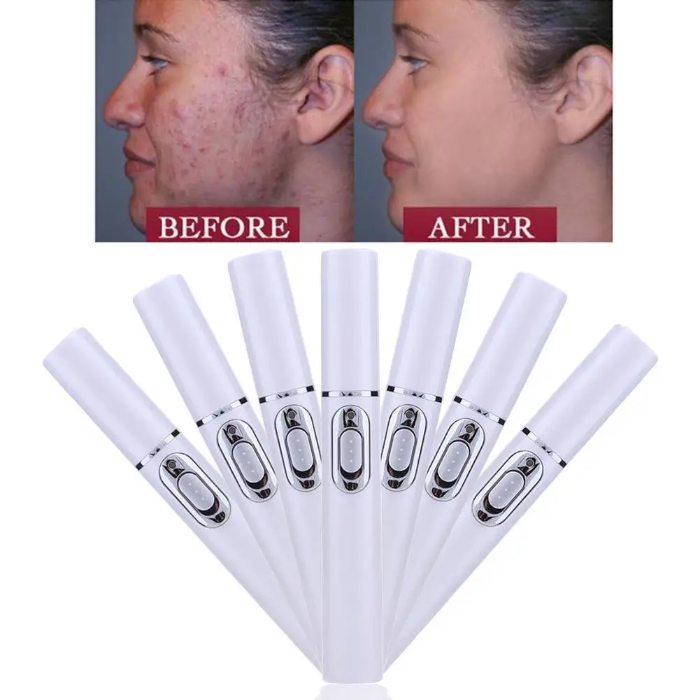Acne Laser Pen Portable Wrinkle Remover Machine Durable Soft Scar Removal Device Blue Light Therapy Pen Facial Care Tool
Acne Laser Pen Portable Wrinkle Remover Machine Durable Soft Scar Removal Device Blue Light Therapy Pen Facial Care Tool