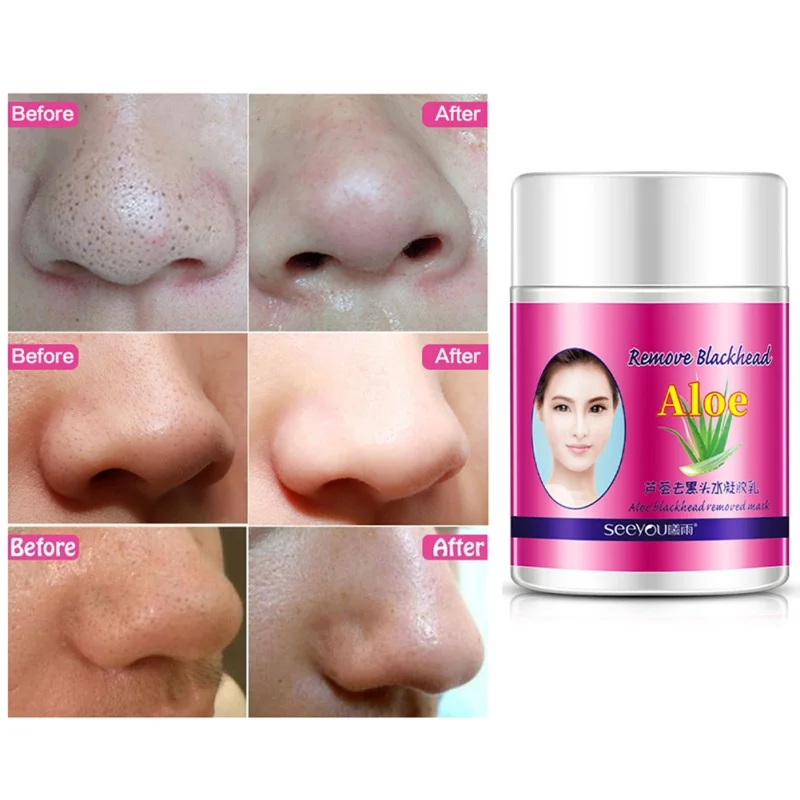 New Nose Black Dots Mask Blackhead Cream Removing Black Head Remover Face Mask Cream Skin Burns Damage Repair Care
New Nose Black Dots Mask Blackhead Cream Removing Black Head Remover Face Mask Cream Skin Burns Damage Repair Care