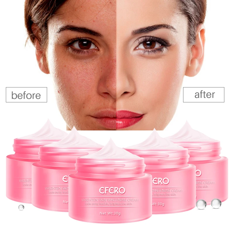 efero 30g Brighten Skin Whitening Face Cream Fade Freckle Smooth Skin Care Hydrating Moisturizer Facial Serum Firming Skin Women
efero 30g Brighten Skin Whitening Face Cream Fade Freckle Smooth Skin Care Hydrating Moisturizer Facial Serum Firming Skin Women
