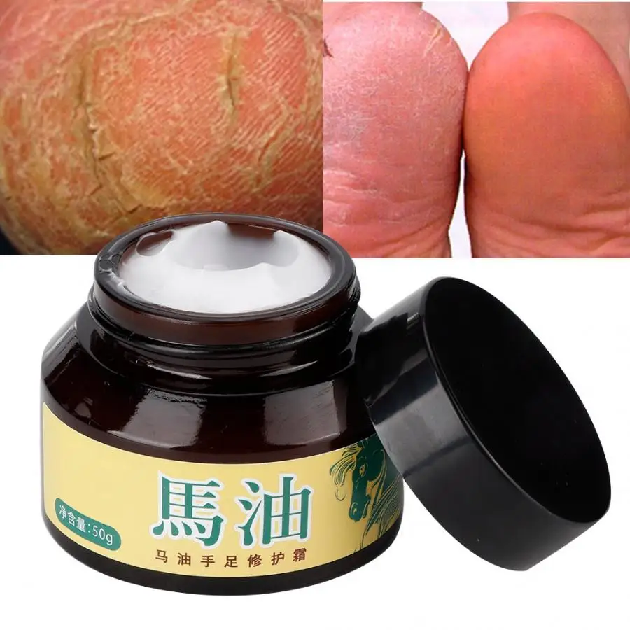 50g Natural Horse Oil Hand Foot Peeling Repair Cream Feet Massage for Athlete's Feet Anti-chapping Smooth Hands Feet Care
50g Natural Horse Oil Hand Foot Peeling Repair Cream Feet Massage for Athlete's Feet Anti-chapping Smooth Hands Feet Care