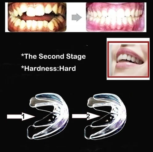 Система прямых зубов для подростков и взрослых ортодонтический фиксатор |