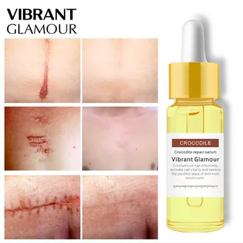 Crocodile Stretch Marks Remover Oil Skin Care Treatment Creme Pregnancy Scar Removal Maternidad Slack line for Pregnant Oils
Crocodile Stretch Marks Remover Oil Skin Care Treatment Creme Pregnancy Scar Removal Maternidad Slack line for Pregnant Oils