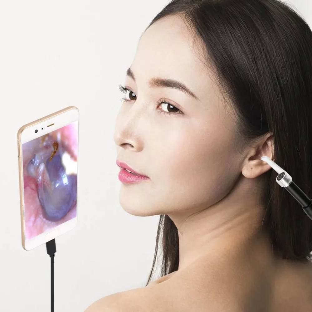 F170 Wireless WiFi Ear Cleaner Earpick Endoscope 5.5mm Lens Otoscope Earwax Cleaning Spoon Remover for Smartphone PC
F170 Wireless WiFi Ear Cleaner Earpick Endoscope 5.5mm Lens Otoscope Earwax Cleaning Spoon Remover for Smartphone PC
