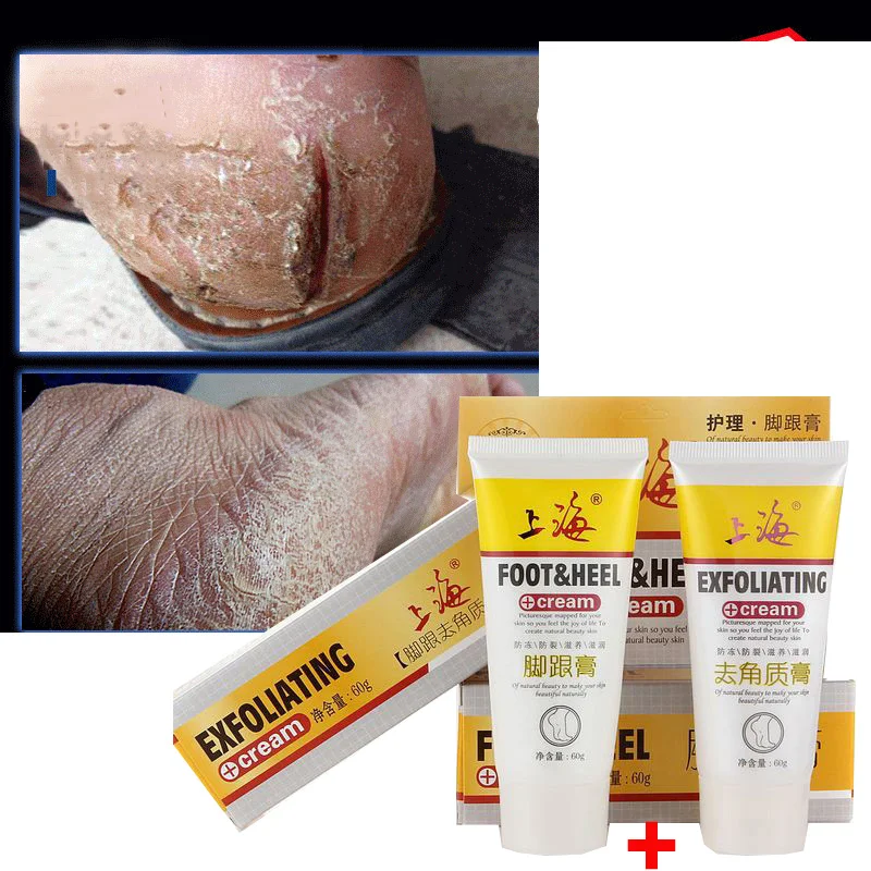 Chinese Cosmetics Hand Foot Crack Cream Care Heel Cream + Heel Exfoliating Cream Foot Care Foot Cream Repair Anti Dry 60g+60g
Chinese Cosmetics Hand Foot Crack Cream Care Heel Cream + Heel Exfoliating Cream Foot Care Foot Cream Repair Anti Dry 60g+60g