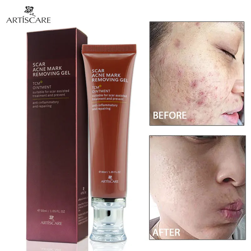 ARTISACRE Acne Scar Removal Cream Skin Repair Acne Spots Acne Treatment Blackhead Whitening Cream Stretch Marks Day Face Cream
ARTISACRE Acne Scar Removal Cream Skin Repair Acne Spots Acne Treatment Blackhead Whitening Cream Stretch Marks Day Face Cream