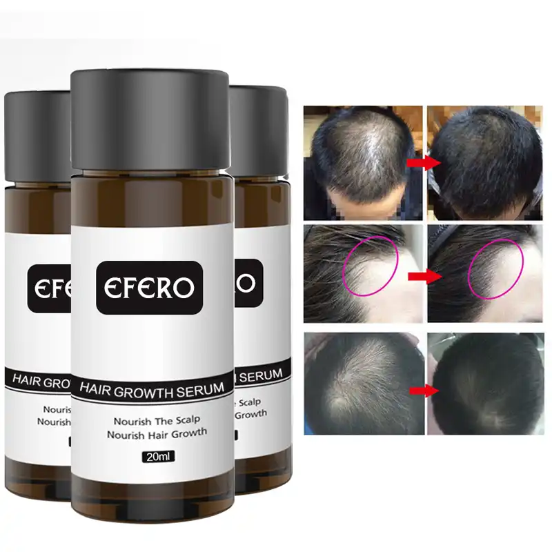 Efero 1pcs Powerful Hair Growth Serum Essence Anti Hair Loss