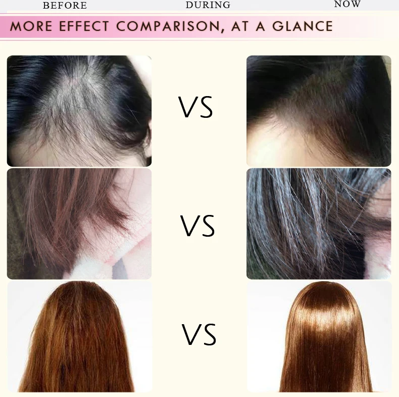 Hair Growth Essence Hair Care Treatment For Men And Women Moroccan Hair Loss Essential Oil Repair Hair Root 5PCS Hair Growth Essence Hair Care Treatment For Men And Women Moroccan Hair Loss Essential Oil Repair Hair Root 5PCS
