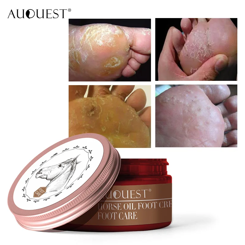 Horse Oil Feet Cream Foot Care For Athlete's Foot Feet Itch Blisters Anti-chapping Peeling Antibacterial Scar Bad Feet Ointment
Horse Oil Feet Cream Foot Care For Athlete's Foot Feet Itch Blisters Anti-chapping Peeling Antibacterial Scar Bad Feet Ointment
