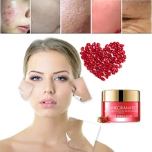 Red Pomegranate Essential Face Cream Acne Scar Removal cream For Whitening Cream Snail Stretch Marks Nourishing For Face 
Red Pomegranate Essential Face Cream Acne Scar Removal cream For Whitening Cream Snail Stretch Marks Nourishing For Face