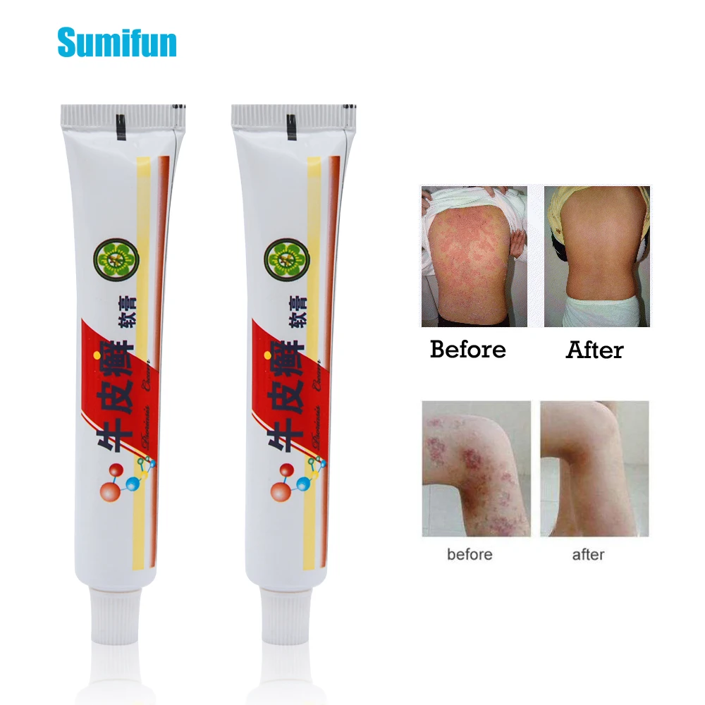 1pcs Psoriasis Creams Body Pain Relief Herbal Eczema Psoriasis Ointment Pruritus Dermatitis Itching Plaster Skin Care P1018
1pcs Psoriasis Creams Body Pain Relief Herbal Eczema Psoriasis Ointment Pruritus Dermatitis Itching Plaster Skin Care P1018