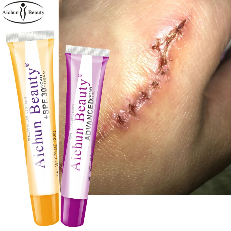 2pcs Face Beauty Scar Removal Cream Skin Repair Face Cream Blemish Spots Pigmentation Corrector Stretch Marks Gel
2pcs Face Beauty Scar Removal Cream Skin Repair Face Cream Blemish Spots Pigmentation Corrector Stretch Marks Gel