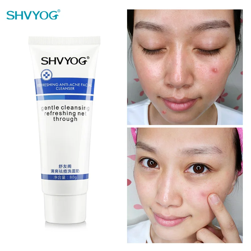 Anti-Acne Facial Cleanser Bubble Oil Control Shrink Pores Face Washing For Women Acne Treatment Exfoliating Deep Cleansing Mens
Anti-Acne Facial Cleanser Bubble Oil Control Shrink Pores Face Washing For Women Acne Treatment Exfoliating Deep Cleansing Mens