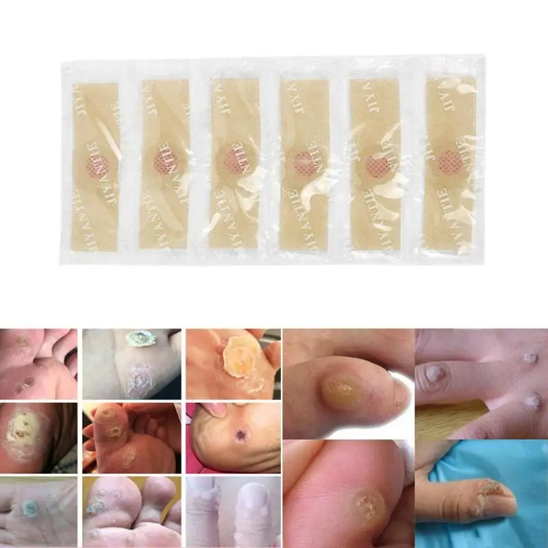 30pcs/set Foot Care Stickers Medical Plaster Chicken Eye Corns Patches Medical Plaster Foot Corn Removal
30pcs/set Foot Care Stickers Medical Plaster Chicken Eye Corns Patches Medical Plaster Foot Corn Removal