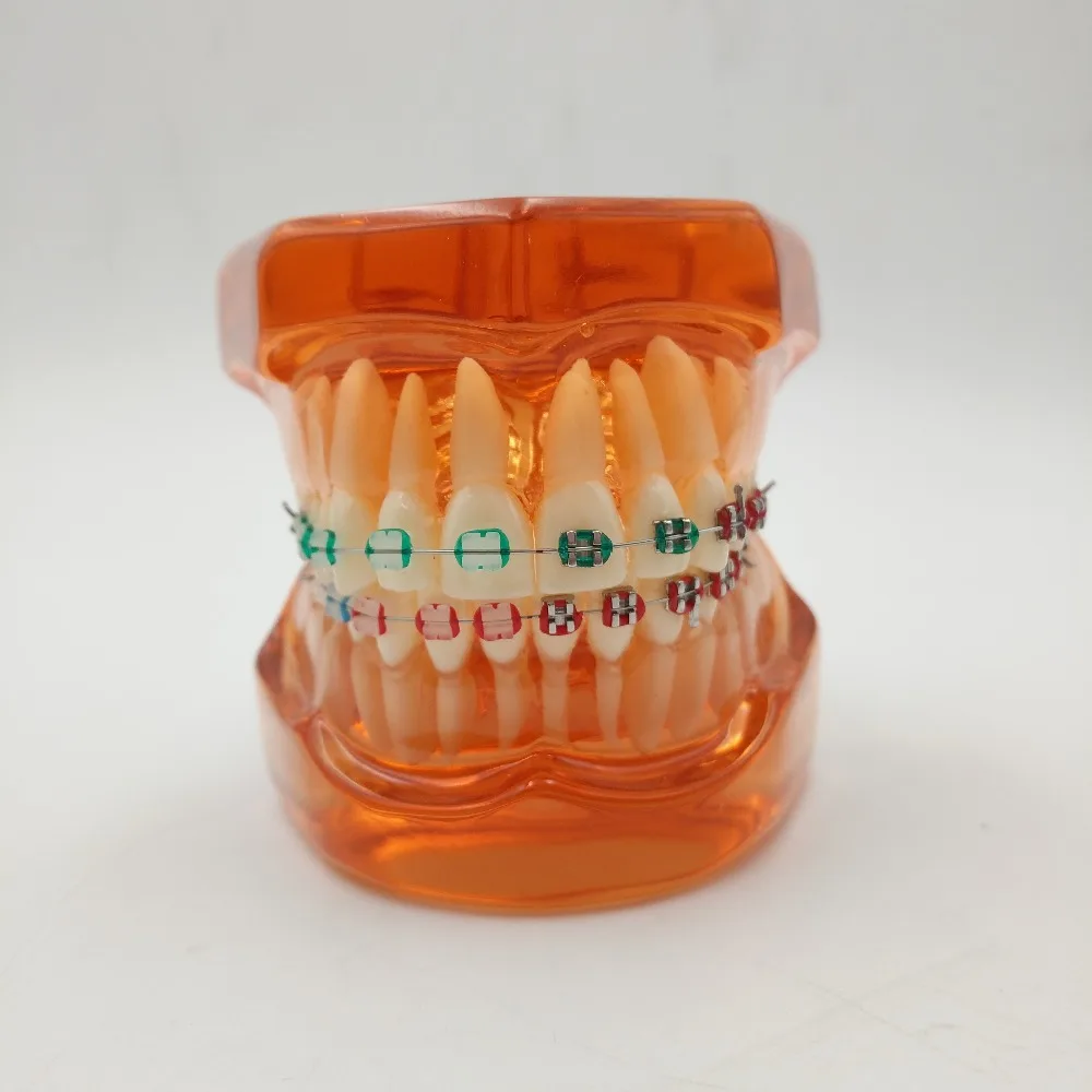 Good Quality Teeth model With metal & ceramic brackets Irregular tooth Ortho Metal dentist patient student learning model
Good Quality Teeth model With metal & ceramic brackets Irregular tooth Ortho Metal dentist patient student learning model