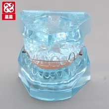 Functional Appliances model Dentistry teaching Patient communication model free shipping
Functional Appliances model Dentistry teaching Patient communication model free shipping